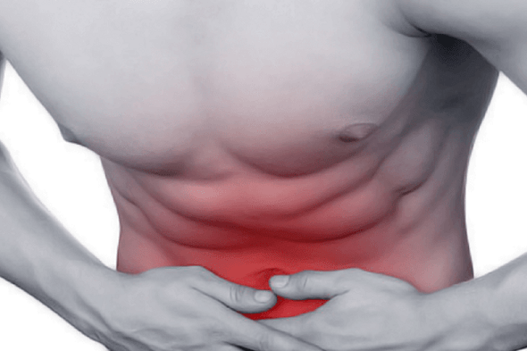 Abdominal pain due to chronic prostatitis
